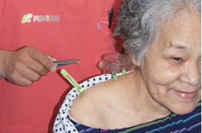 鍼灸治療の様子